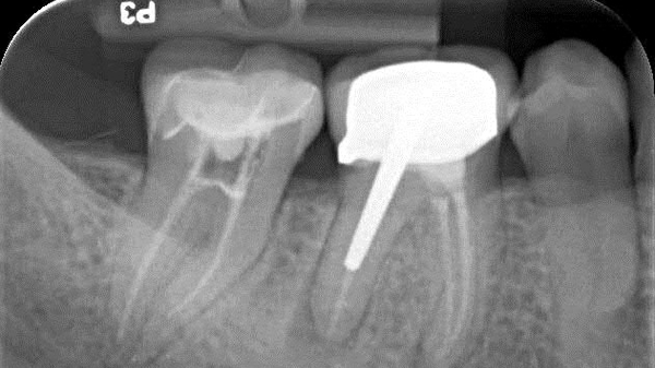 Endodontie vom Spezialisten: Dr. Ritter M.Sc. (Endodontologie)